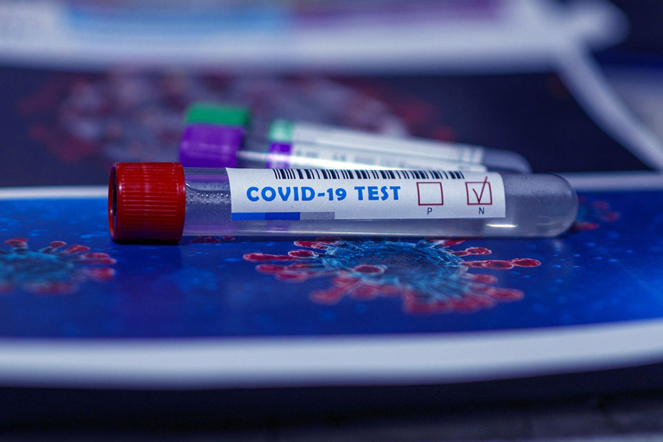 COVID-19 test vial placed on top of image of coronavirus molecule.