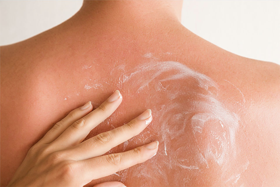 Hand rubs sunscreen into individual's back.